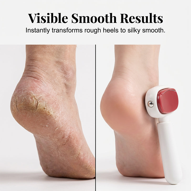 Double-Sided Foot Scraper – Easily Removes Calluses and Dead Skin ✨🦶